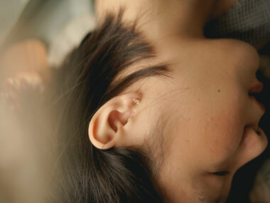 Mucopolysaccharidosis hearing loss