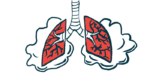 Sanfilippo lung health | Sanfilippo News | human lungs