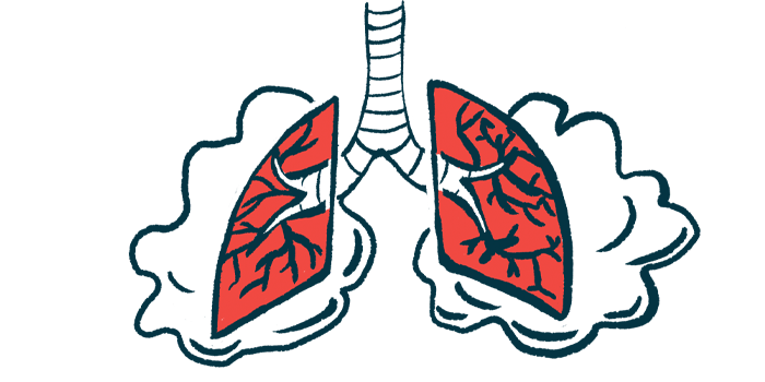 Sanfilippo lung health | Sanfilippo News | human lungs