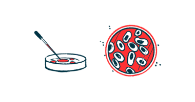 Brain-in-a-Dish models | Sanfilippo Syndrome News | illustration of cells in petri dishes