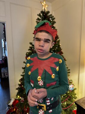 A boy, his eyes nearly closed, stands in front of a Christmas tree. He's wearing an elf outfit that's mostly green with splashes of red, a black belt, yellow buttons, and a red and green hat.
