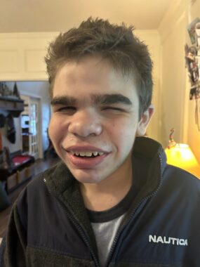 A close-up shows a young boy with Sanfilippo syndrome smiling broadly in the living room of a home.